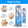 Vitiligo Cream, Vitiligo Treatment for Skin Vitiligo, Vitiligo Care Cream for Reduce White Spots and Improve Skin Pigmentation