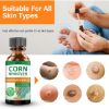 Picture of Corn Removers for Feet,Corn Removers for Toe, Foot Corn-Toe Corn-Callus Removal, Corn Remover Feet,Toes Corn