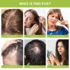 Picture of Rice Water for Hair Growth, Hair Growth Serum for Scalp & Hair Strengthening, Hair Growth Spray Suitable for Damaged & Dry Hair Treatmênt