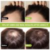Picture of Rice Water for Hair Growth, 100mL Hair Growth Serum with Ginger Extract, Black Rice Water Spray for Stronger, Thicker and Longer Hair Regrowth, Hair Loss and Thinning Treatment for Women and Men